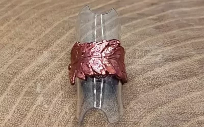 Anello felce 2